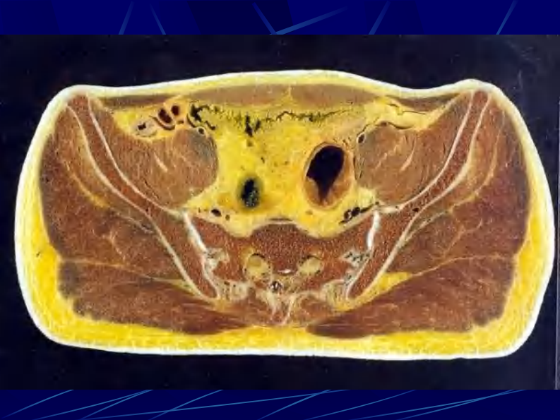 11 男性盆部和会阴断层解剖.pdf 第4页