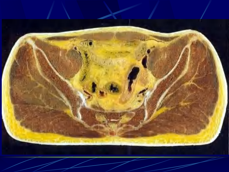 11 男性盆部和会阴断层解剖.pdf 第5页