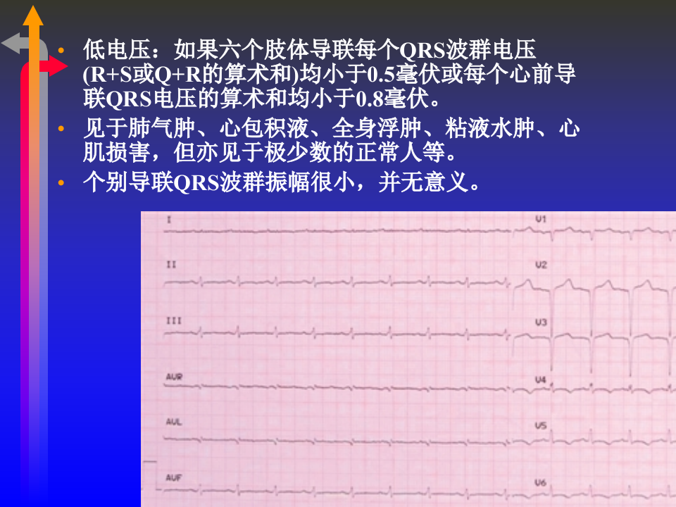 心电图－第二次课（3节）.ppt 第3页
