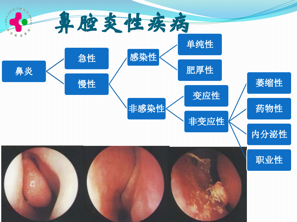 2011级临床口腔-慢性鼻炎变应性鼻炎鼻息肉-教室.ppt 第2页