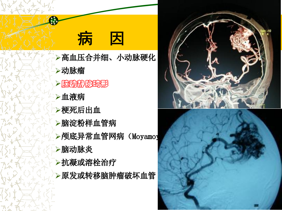 4)春季2012级放射口腔CH.ppt 第5页