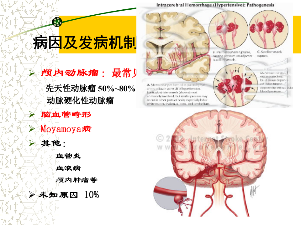 5)级放射口腔SAH.ppt 第3页