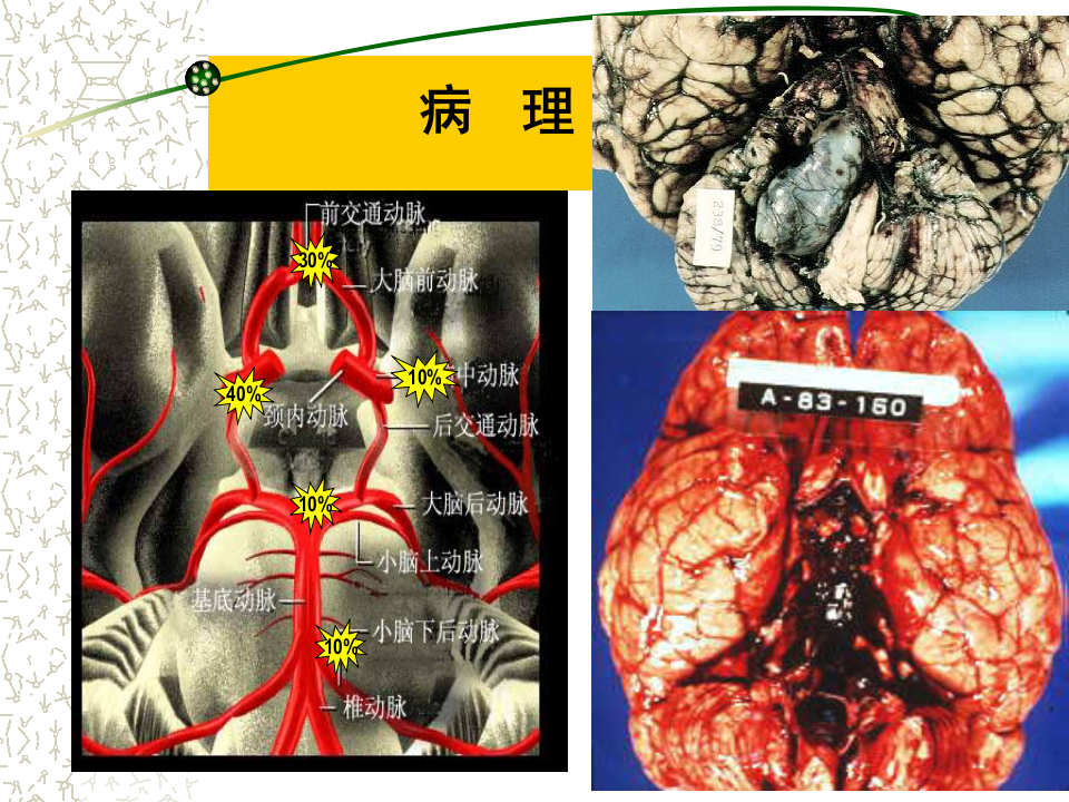 5)级放射口腔SAH.ppt 第5页