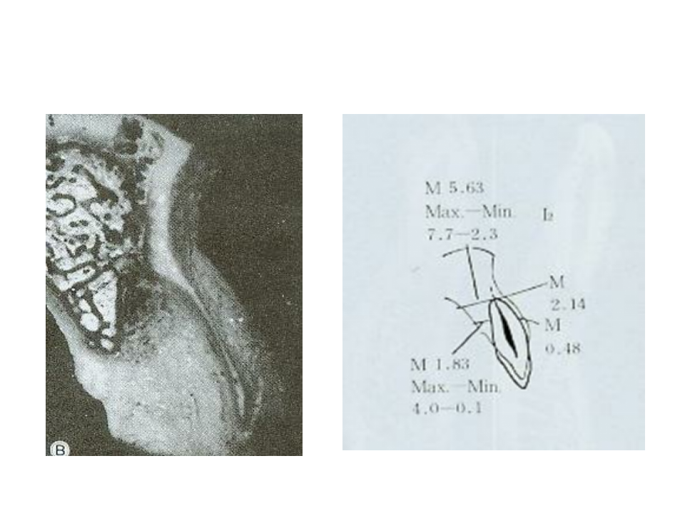 牙槽嵴与牙槽窝骨性解剖.ppt 第4页