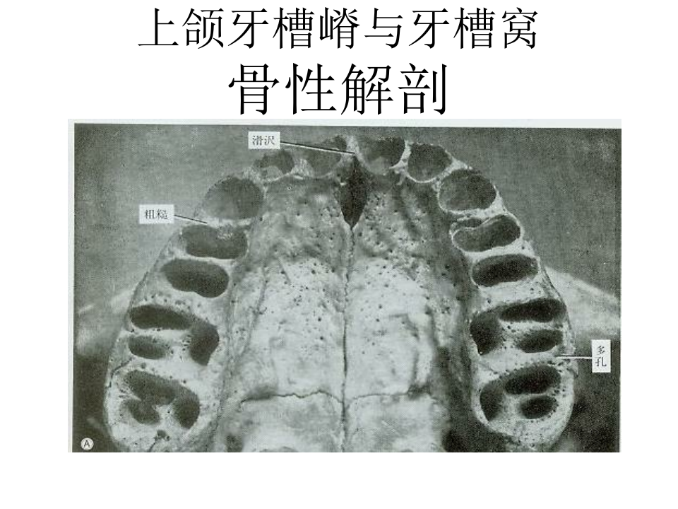 牙槽嵴与牙槽窝骨性解剖.ppt 第2页