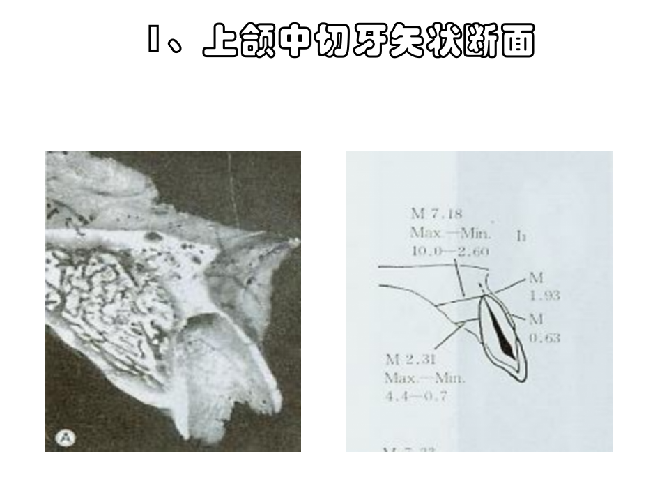 牙槽嵴与牙槽窝骨性解剖.ppt 第3页