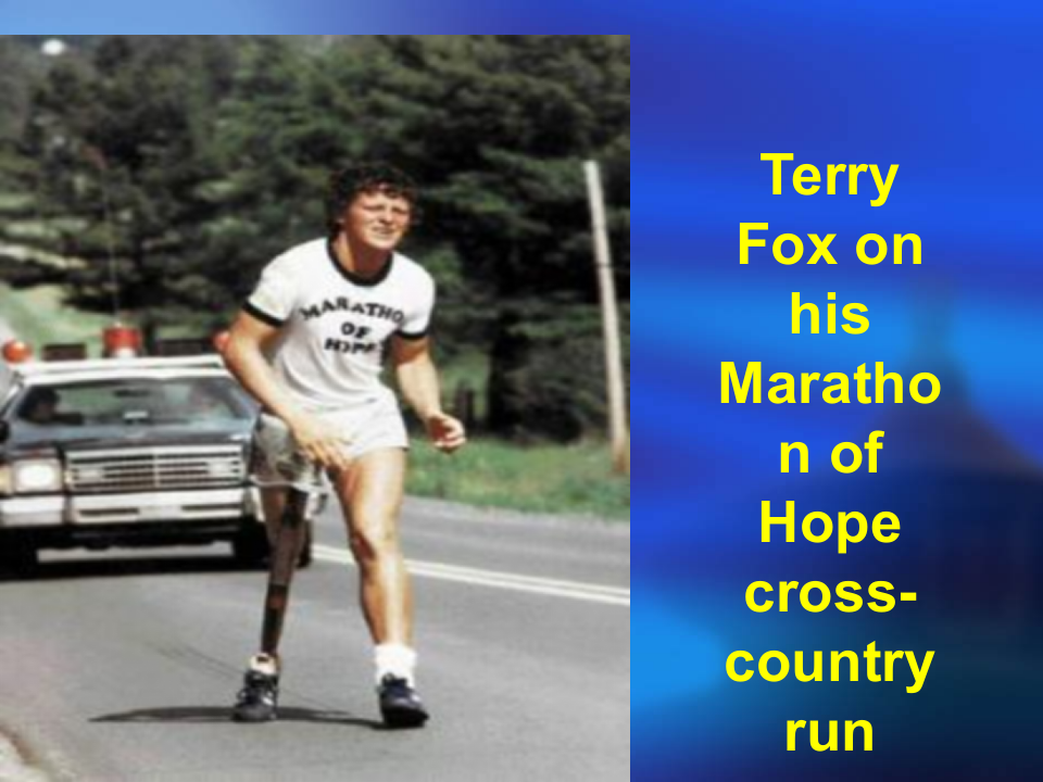 骨肿瘤课件.ppt 第3页