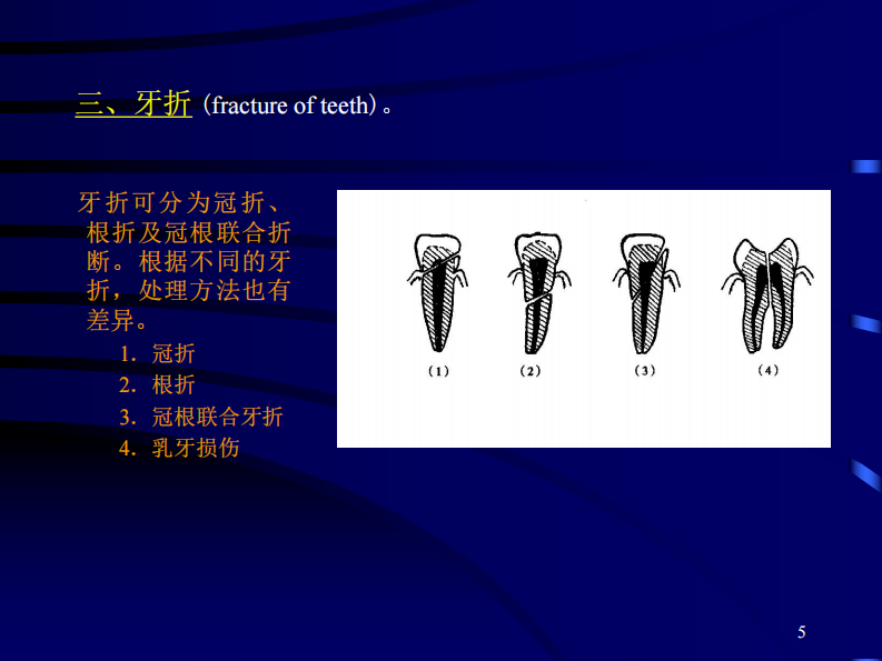 口腔颌面部损伤-南方医院.pdf 第5页