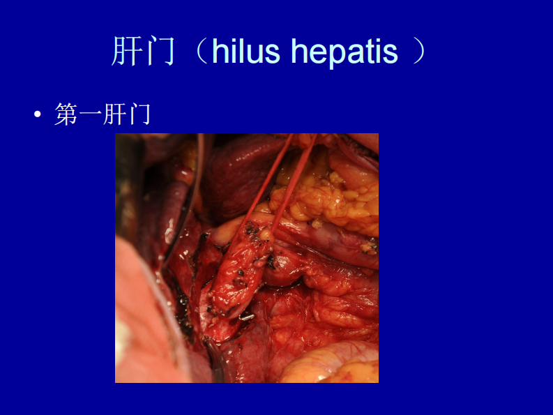 76内科-肝脏疾病.pdf 第3页