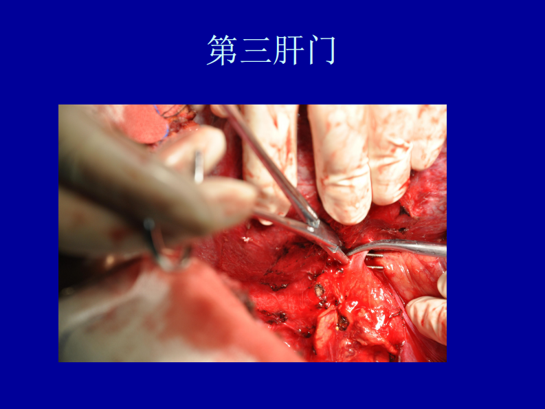 76内科-肝脏疾病.pdf 第5页