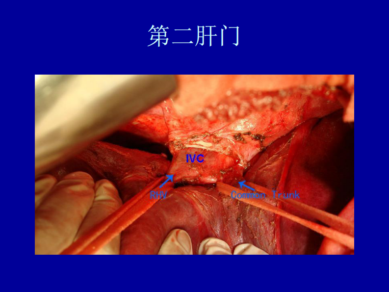 76内科-肝脏疾病.pdf 第4页