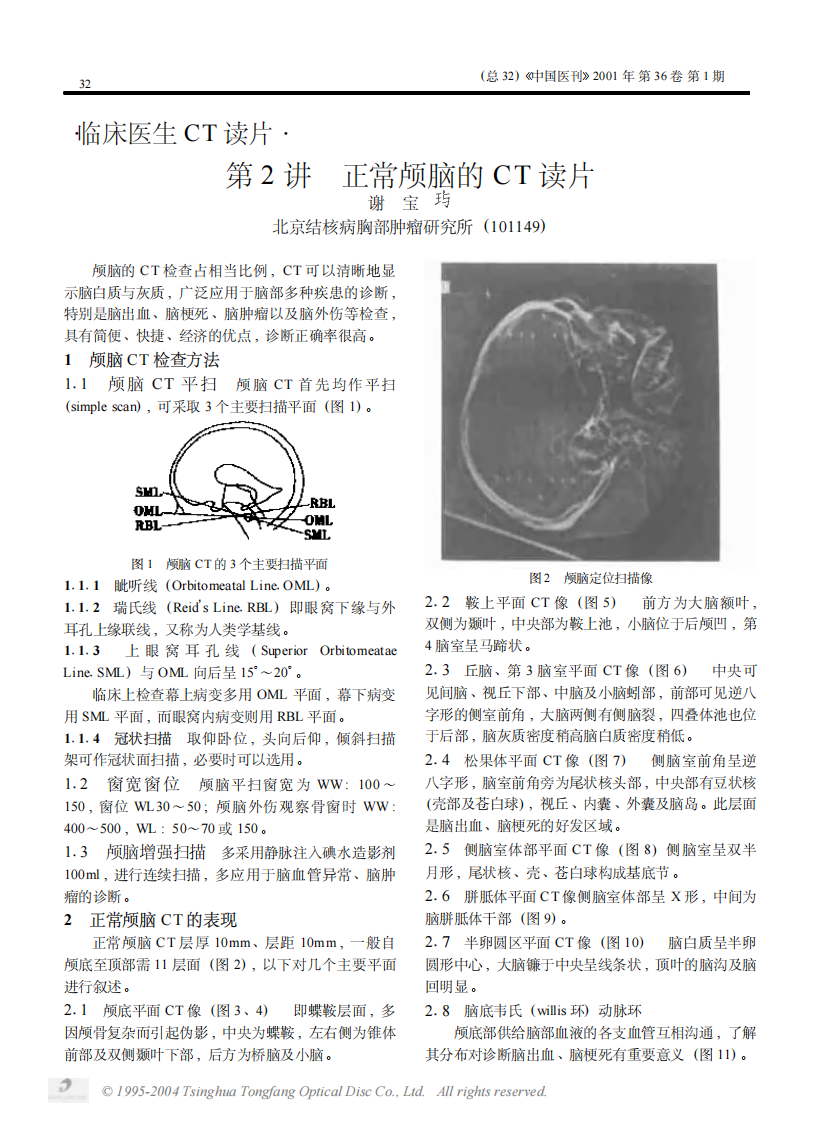临床医生CT读片.pdf 第5页