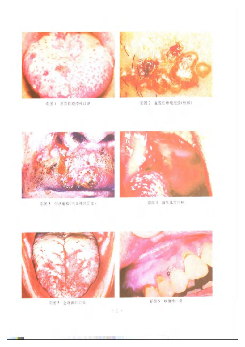 口腔粘膜病学第2版.pdf 第4页