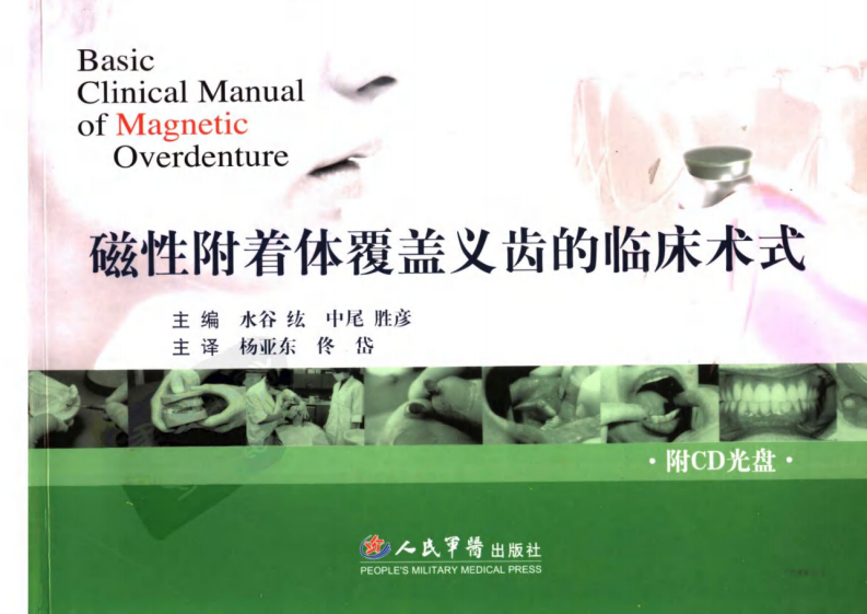 磁性附着体覆盖义齿的临床术式.pdf 第1页
