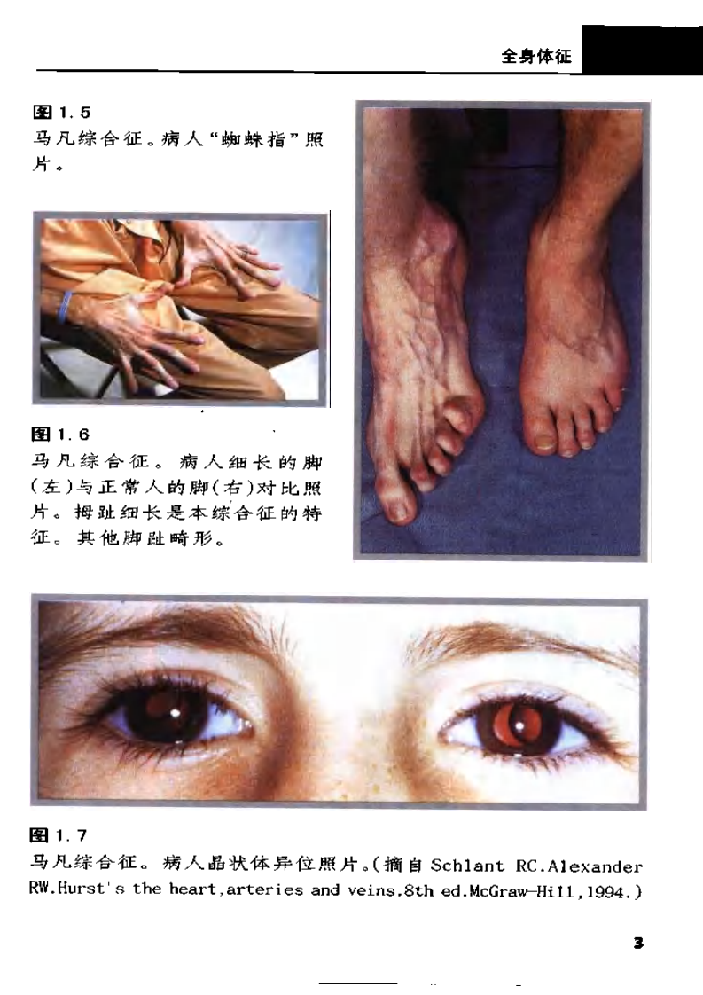 心血管病体征诊断彩色图谱（中文扫描版）.pdf 第5页
