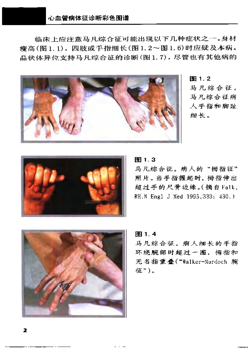 心血管病体征诊断彩色图谱（中文扫描版）.pdf 第4页