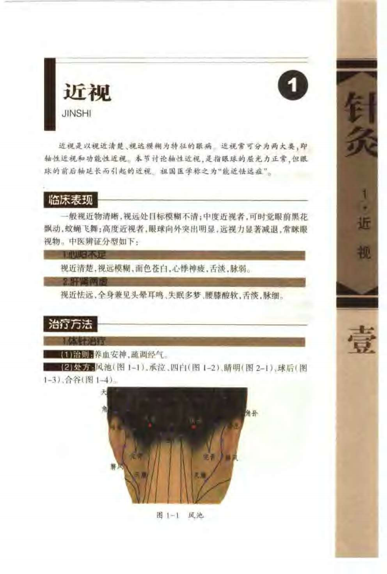 针灸治疗常见病证图解 五官科分册（张建华）.pdf 第4页