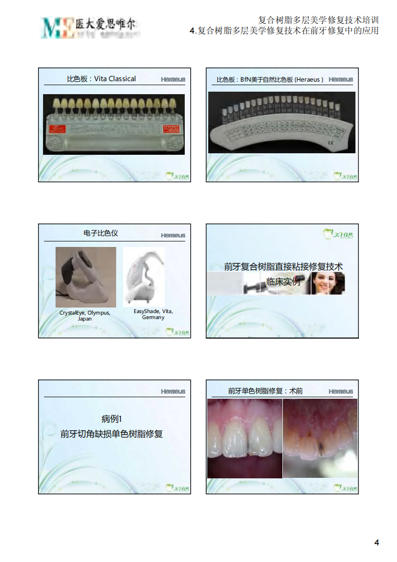 4.复合树脂多层美学修复技术在前牙修复中的应用.PDF 第4页