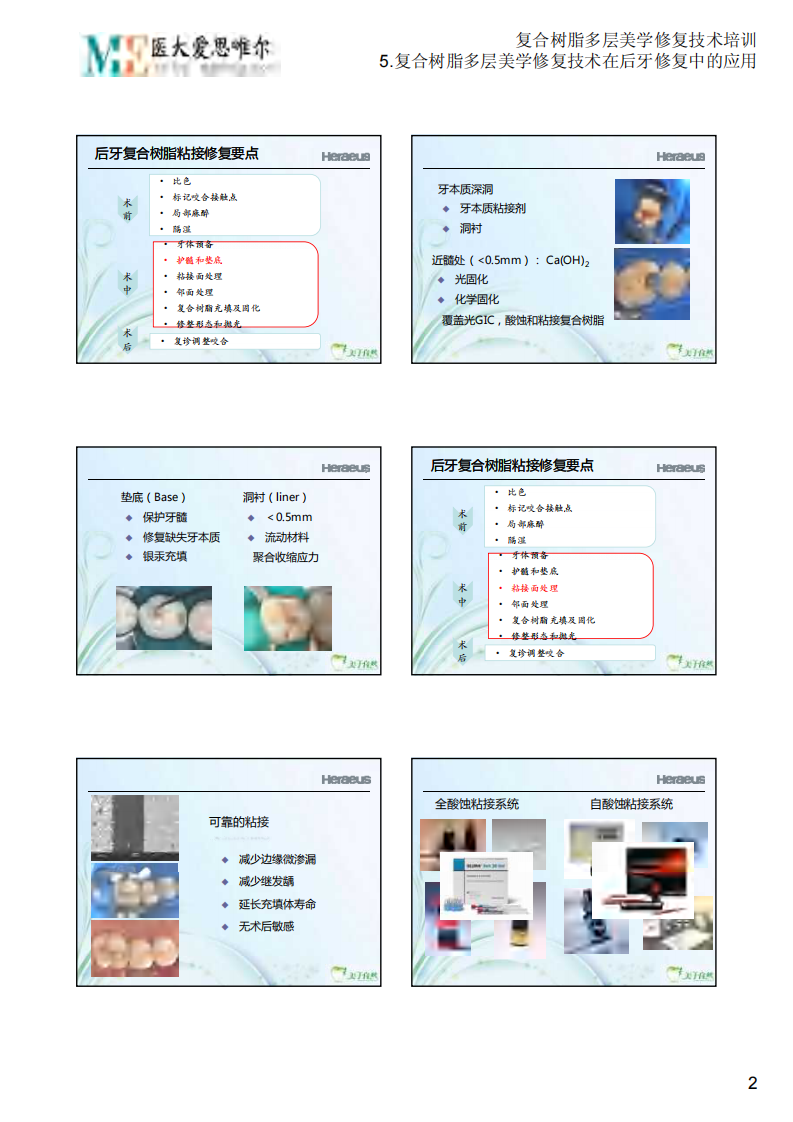 5.复合树脂多层美学修复技术在后牙修复中的应用.PDF 第2页