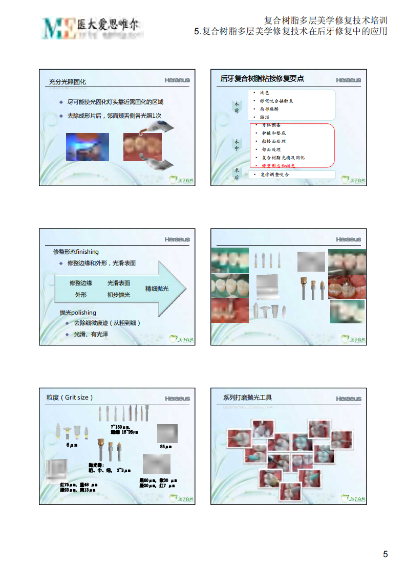 5.复合树脂多层美学修复技术在后牙修复中的应用.PDF 第5页
