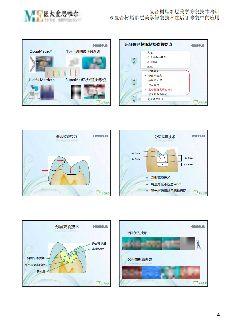 5.复合树脂多层美学修复技术在后牙修复中的应用.PDF 第4页