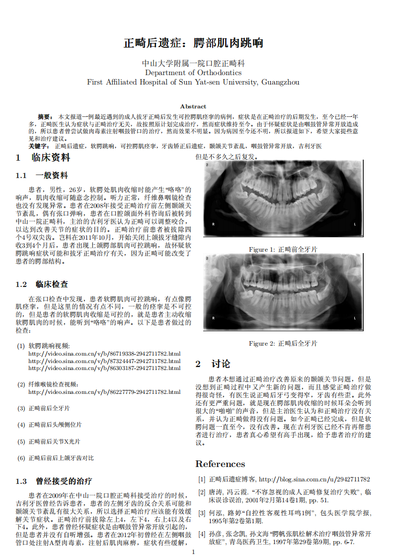 矫正牙齿后遗症.pdf 第1页
