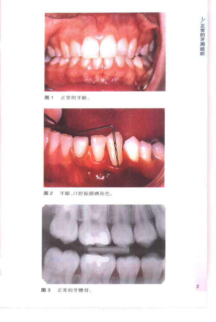 大川分享_袖珍诊疗彩色图谱系列 牙周病学[英]希斯曼（Heasman，P.）等编著.pdf 第4页