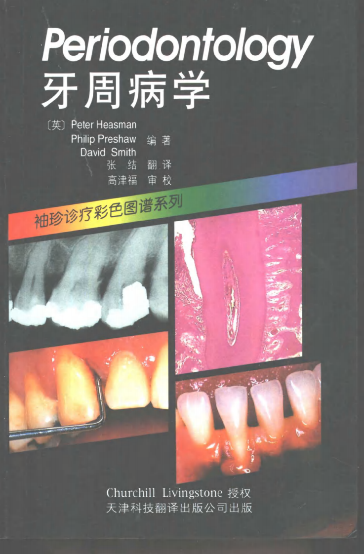 袖珍诊疗彩色图谱系列 牙周病学[英]希斯曼（Heasman，P.）等编著.pdf 第1页