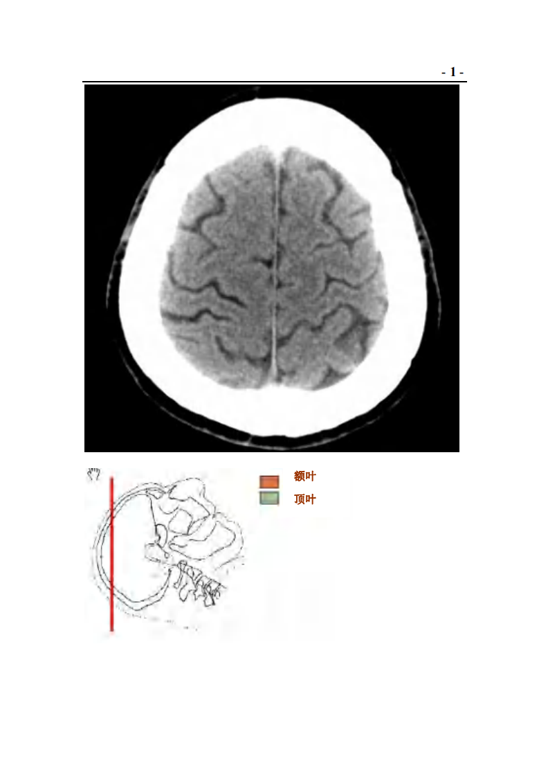 神经外科CT与MRI头颈部.pdf 第5页