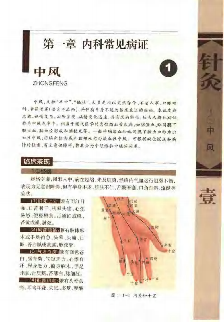 针灸治疗常见病证图解 内科分册（张建华）.pdf 第5页