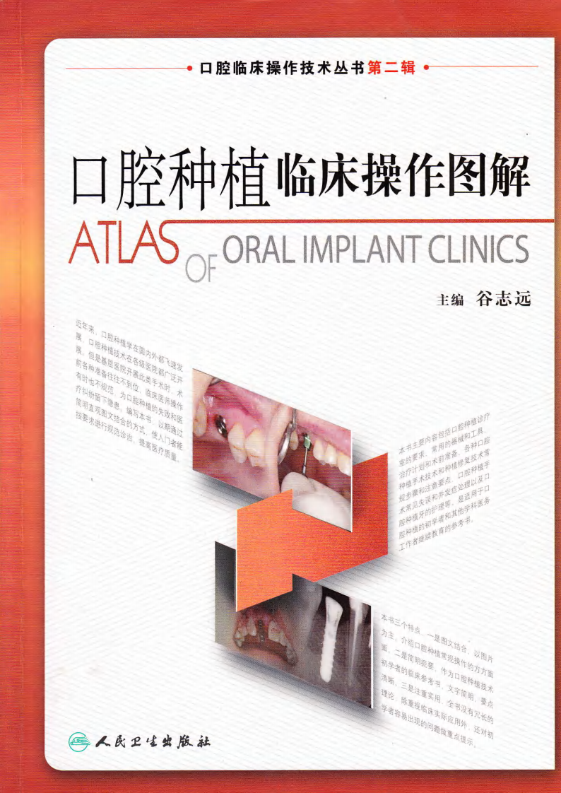 口腔种植临床操作图解——更多口腔专业知识，请访问：牙医圈www.yayiquan..pdf 第1页
