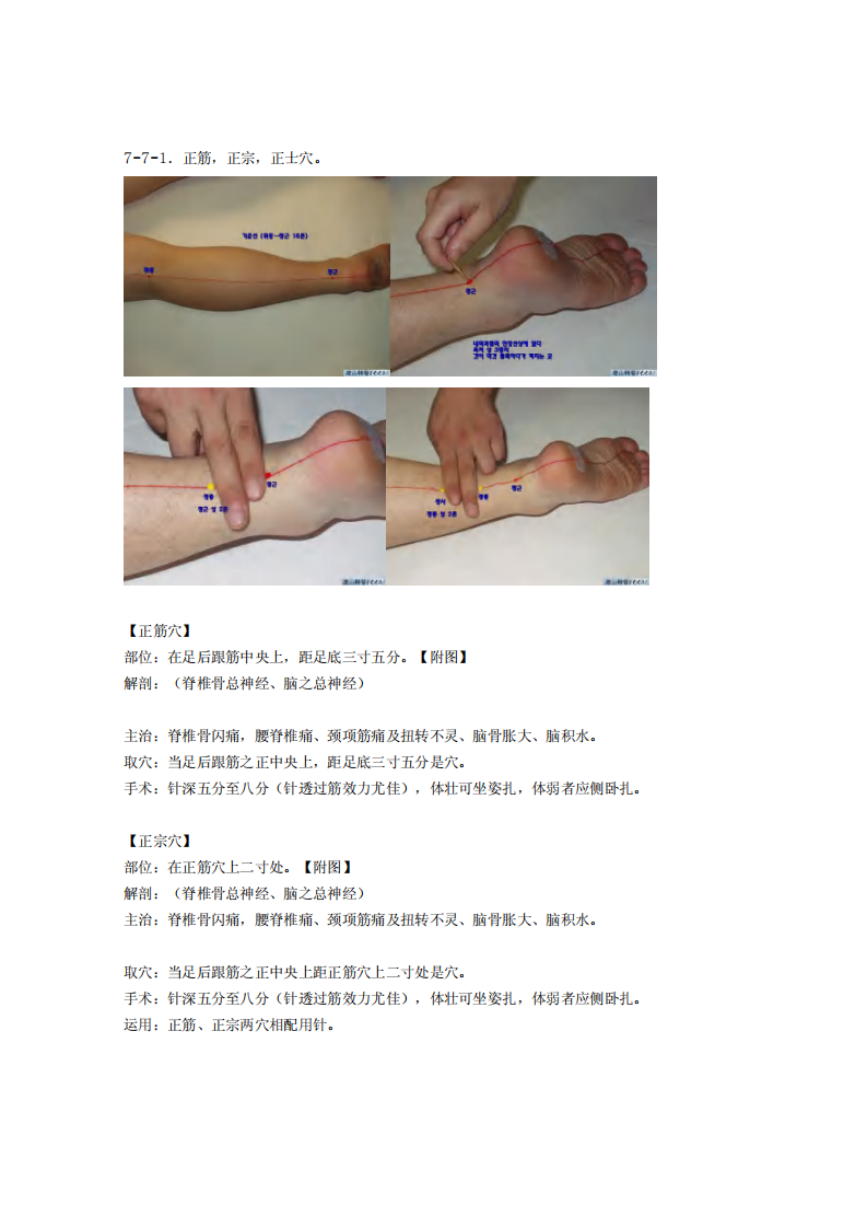 童氏奇穴发挥整理7-7.pdf 第1页