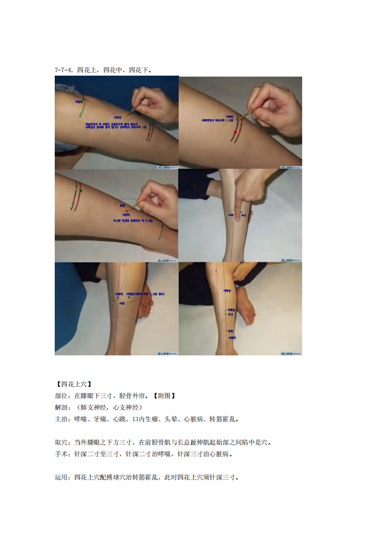 童氏奇穴发挥整理7-7.pdf 第5页