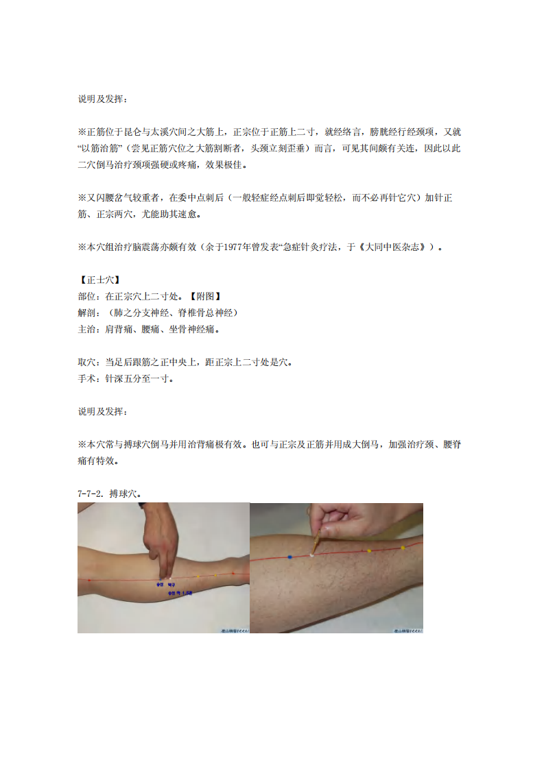 童氏奇穴发挥整理7-7.pdf 第2页