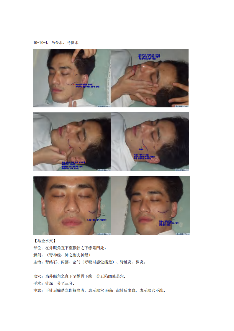 童氏奇穴发挥整理10-10.pdf 第3页