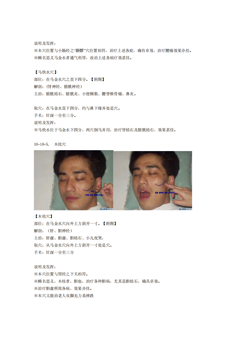 童氏奇穴发挥整理10-10.pdf 第4页