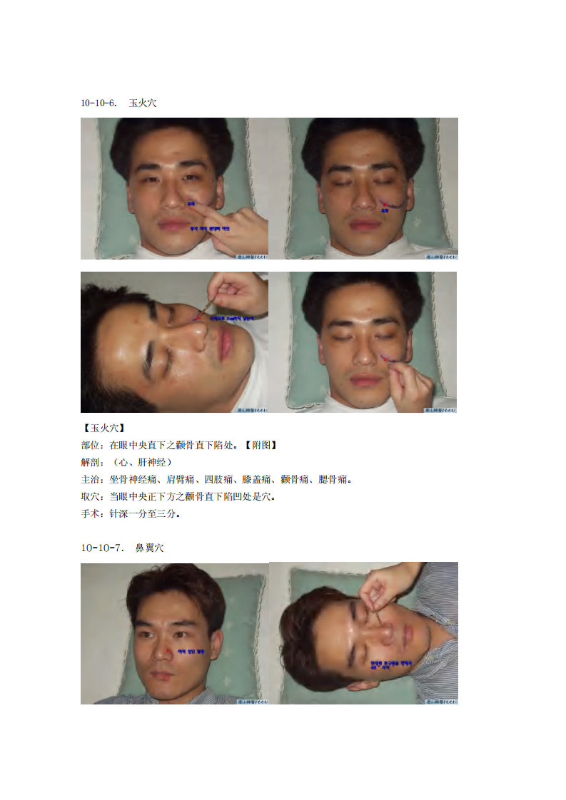 童氏奇穴发挥整理10-10.pdf 第5页