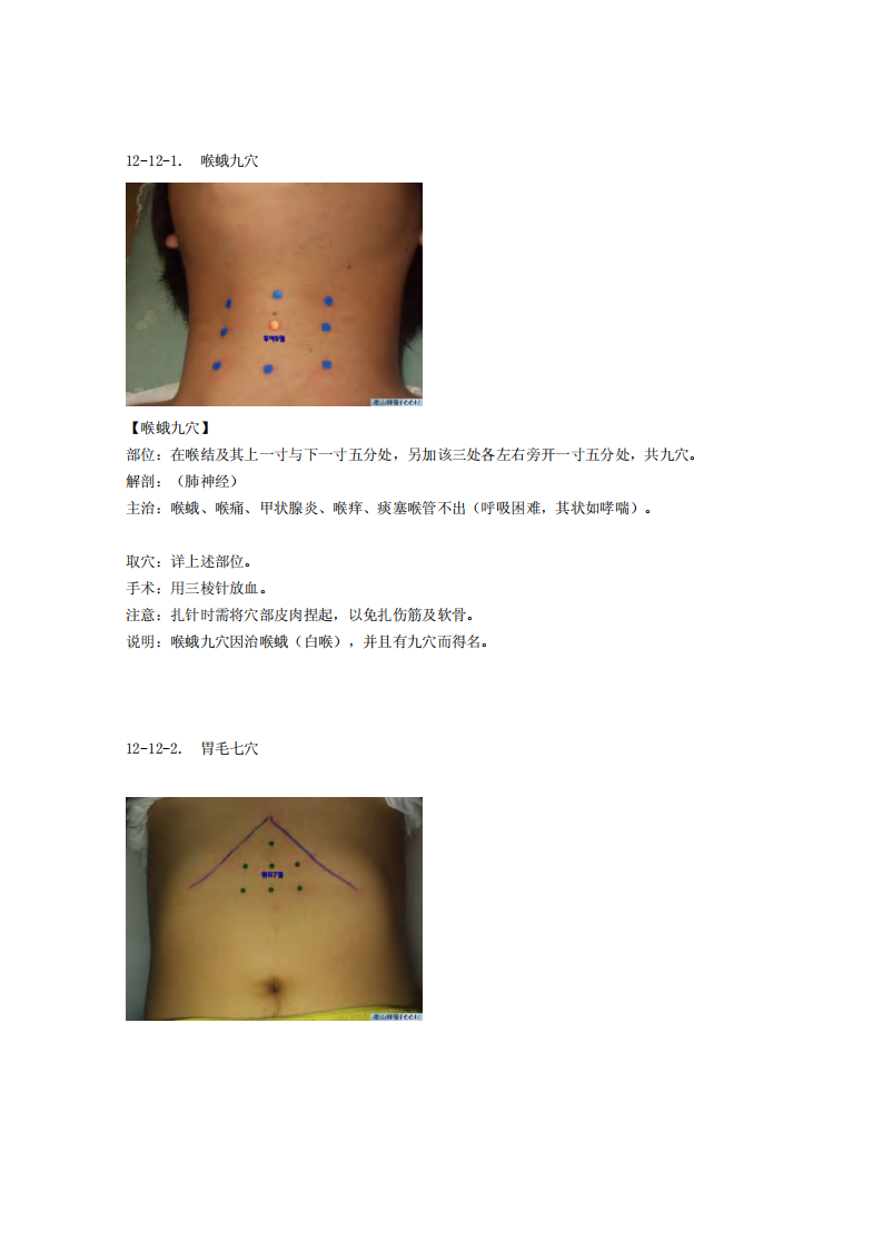 童氏奇穴发挥整理12-12.pdf 第1页