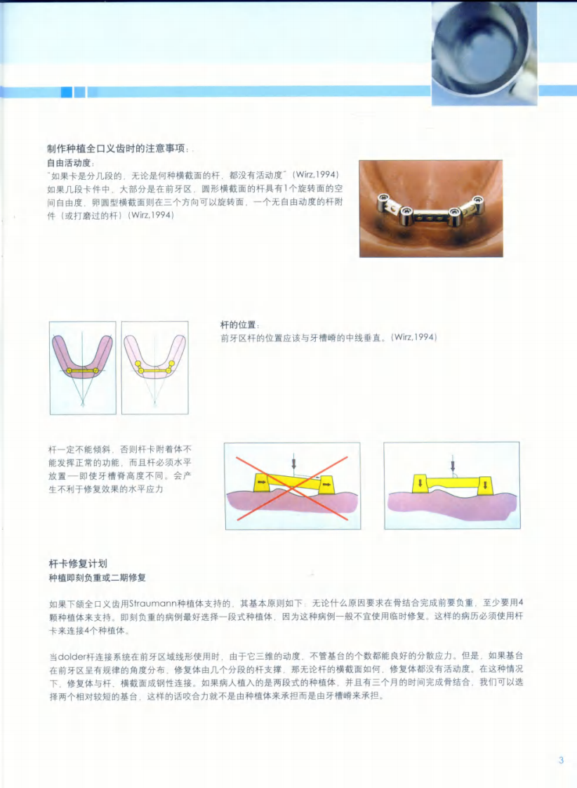 153ITI全口修复.pdf 第5页
