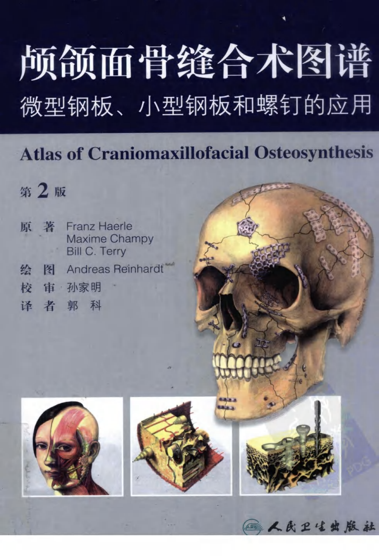 颅颌面骨缝合术图谱：微型钢板小型钢板和螺....pdf 第1页