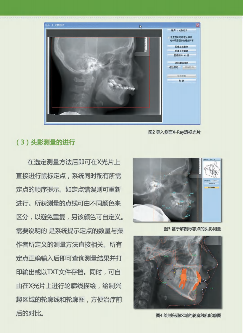正畸头影.pdf 第5页