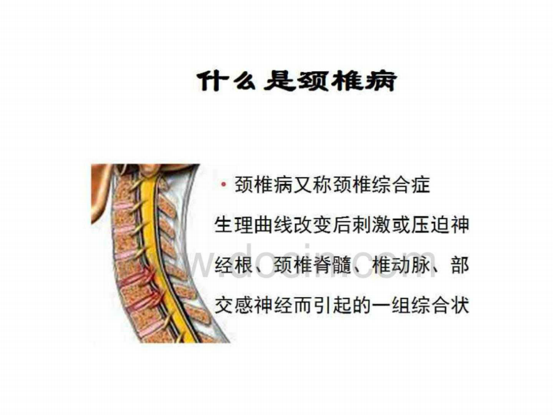 专家图解颈椎病的预防与保健.pdf 第3页