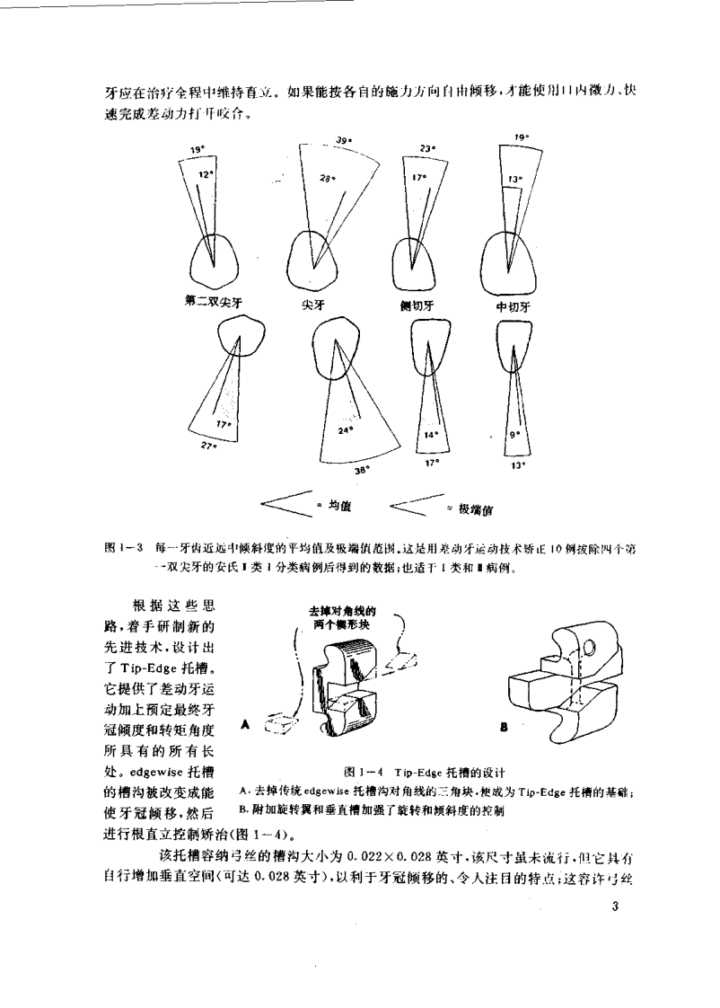 大川分享_Tip-Edge矫正技术.pdf 第4页