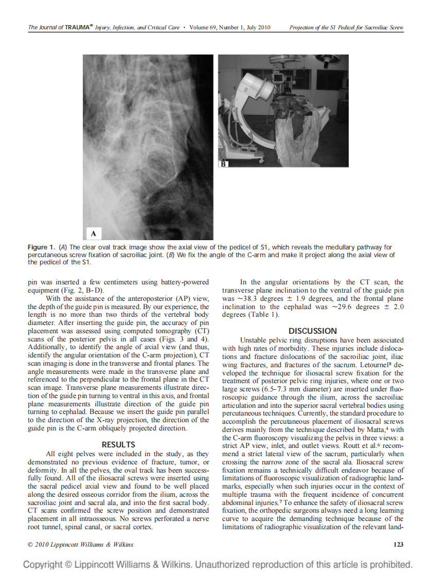 骶1椎弓根轴位 侯志勇.pdf 第2页