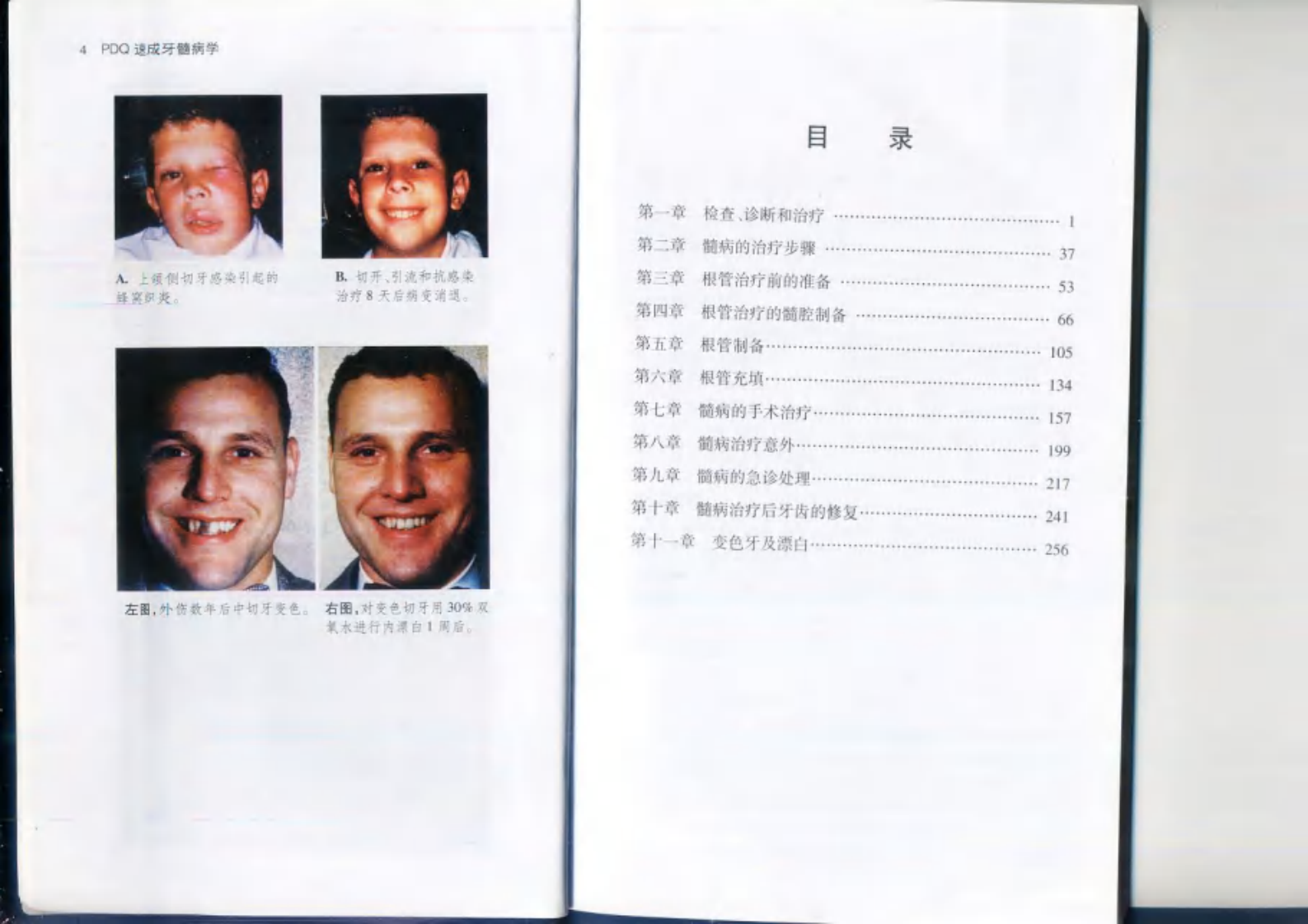 PDQ速成牙髓病学——更多口腔专业知识，请访问：牙医圈www.yayiquan..pdf 第1页