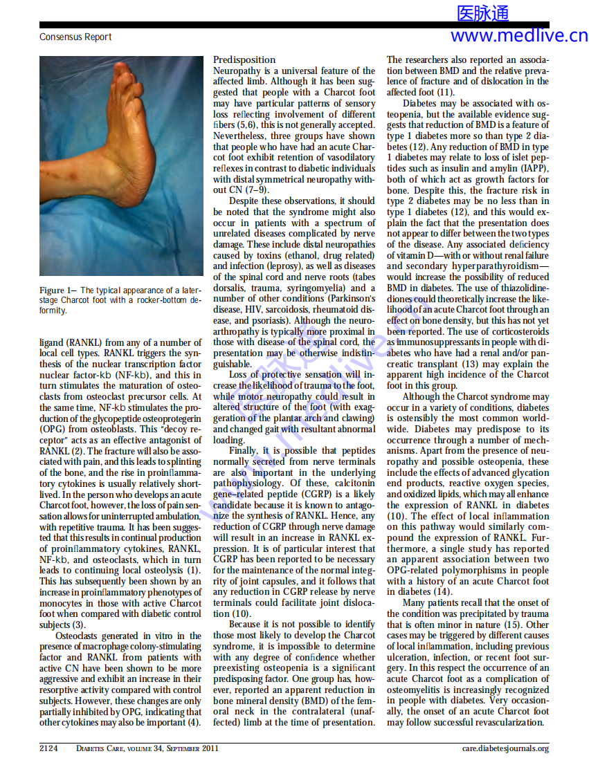 糖尿病夏科足（国际专家共识）-2011.pdf 第2页