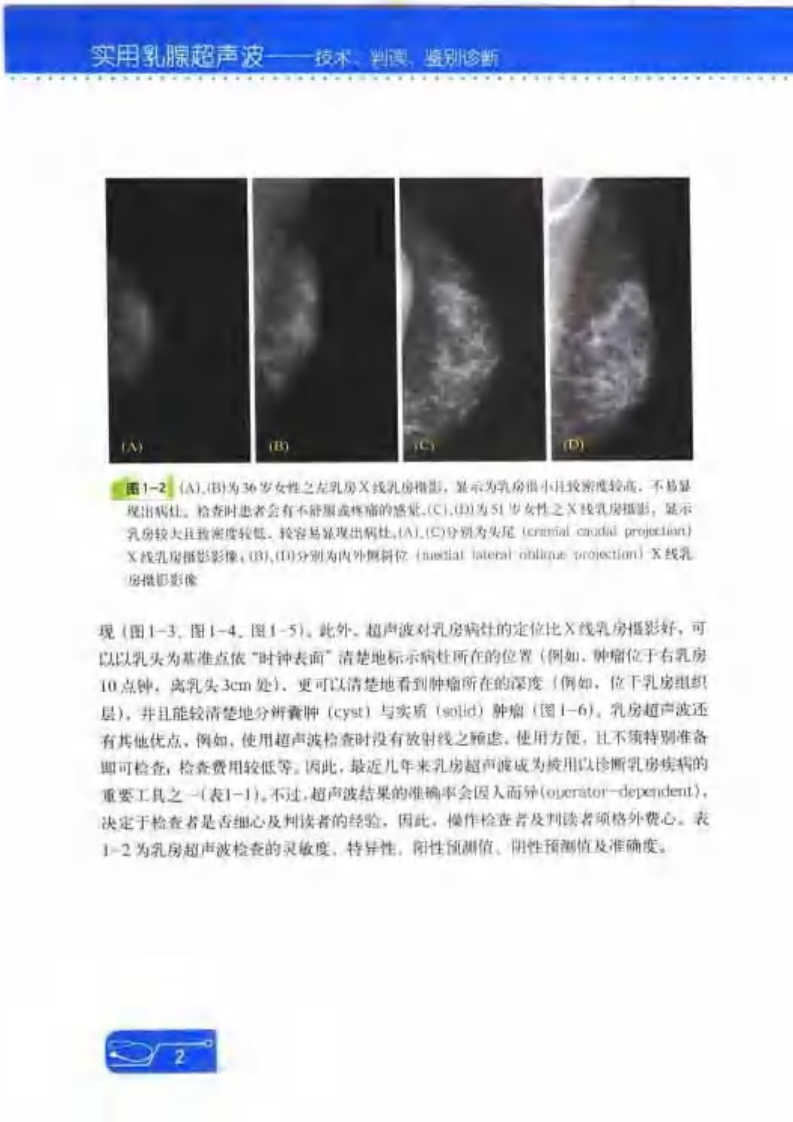 实用乳腺超声波技术判读.pdf 第4页