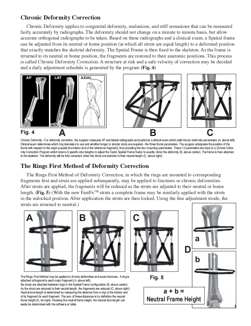 泰勒支架说明书.pdf 第4页