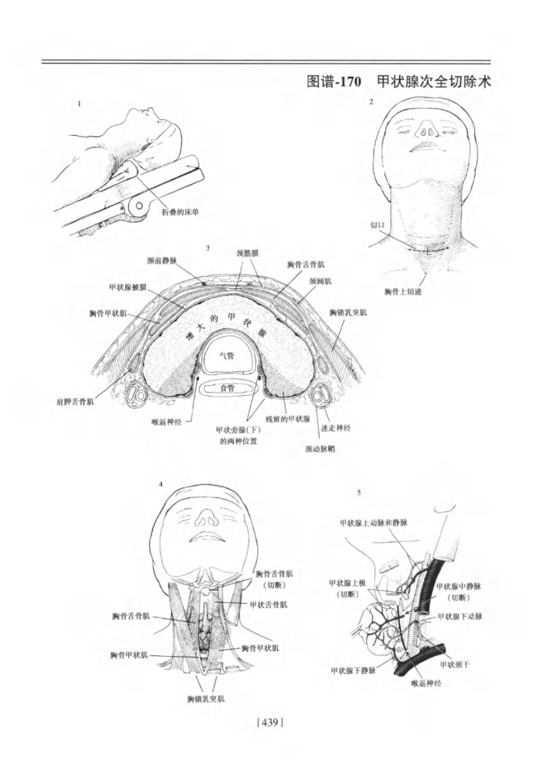甲状腺及颈清--提取自佐林格外科手术图谱.pdf 第3页