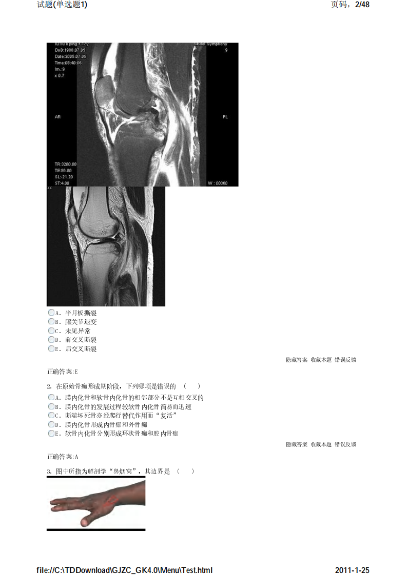 考试宝典 医学高级职称考试 骨科 单选题1.pdf 第2页